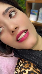 48K views · 5.4K reactions | vampire teeth ভ্যাম্পায়ার দাঁত বানালো এই আপুটি ✅#foryou | Rupa Bright Dental Care | Facebook