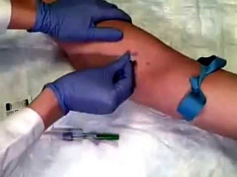 How to Perform Venipuncture (Phlebotomy Training Video)