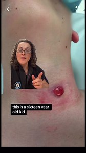 6.9K views · 51 reactions |  Persistent neck infection despite...