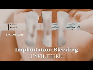 IMPLANTATION BLEEDING **WITH PICTURES | Two Week Wait, Bfp / Bfn Symptoms