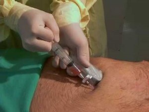 Emergency Pericardiocentesis NEJM