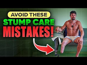 How I Take Care of My Stump as an Amputee
