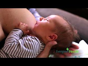 Engorgement After Giving Birth