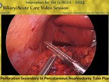 Colon Perforation Secondary to Percutaneous Nephrostomy Tube Placement • Video • MEDtube.net