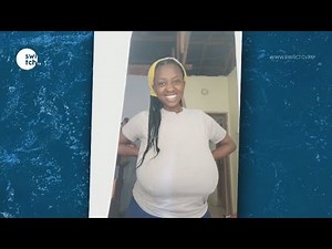 'Your breasts look a little too large for your age' Pauline transformational breast surgery journey