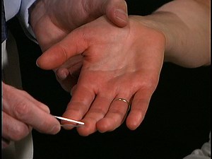 Neurologic Exam-Adult | Sensory Exam | Normal | Two-Point Discrimination