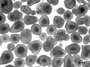 File:Generation-of-Highly-Purified-Human-Cardiomyocytes-from-Peripheral-Blood-Mononuclear-Cell-Derived-pone.0126596.s002.ogv - Wikimedia Commons