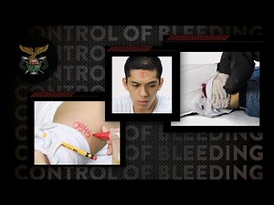 UP ROTC - Control of Bleeding | First Aid