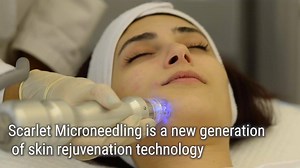 Check out our latest offers on the Scarlet Radiofrequency...