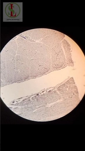 Skeletal Muscle 💪 Under Microscope 🔬