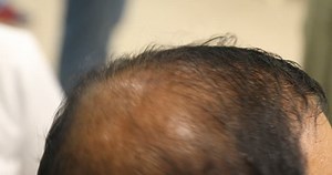 「禿頭の男の背景」の動画素材（ロイヤリティフリー）34320613 | Shutterstock