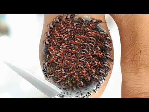 Deep Cleaning Animation ASMR—Removing Ticks, Maggots & Insects From Nail (Satisfying & Relaxing)