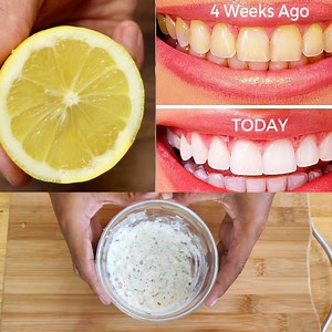 1.4K views · 25 reactions | Whiten Teeth at Home | How To Whiten Your Yellow Teeth Naturally | Post Beauty Tips | Facebook