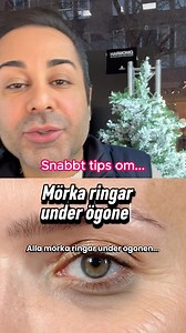 Mörka ringar under ögonen? Här är hur du får bort både tillfälliga och permanenta mörka ringar! ❤️ #mörkaringar #fördig #mörkaringarunderögonen #hudvård #koffeinhudvård #cvitamin #cvitaminhudvård #hudvårdsrutin #skönhetstips | Arman på Harmoniq.se
