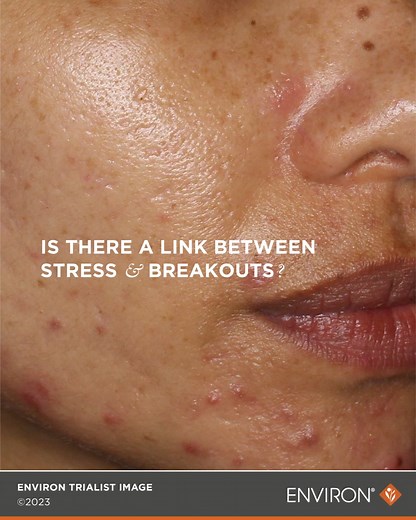 Focus Care Clarity | Environ Skin Care