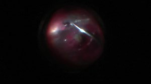 Subretinal Foreign Body Removal - Eyetube