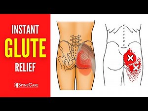 How to Fix Glute Pain FOR GOOD