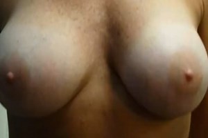 Check Out This Woman's Invisible Scars After Her Scarless Breast Augmentation
