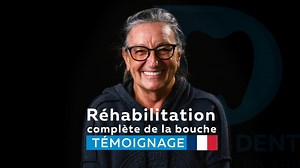 🇫🇷Rencontrez Simone qui a choisi TravelToDentist pour une réhabilitation dentaire complète avec la technique All-on-4 et des prothèses fixes de qualité supérieure et des couronnes individuelles en zircone. #AvantAprèsAllOnFour 🇬🇧Meet Simone who chose TavelToDentist for her full mouth rehabilitation with All-on-4 technique with premium fixed dentures on implants and individual zirconium crowns. #BeforeAndAfterAllOnFour 🇮🇹Incontra Simone che ha scelto TravelToDentist per la sua riabilitazion