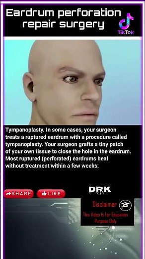 Repair of a perforated eardrum