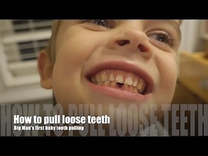 How to pull loose teeth: Big Man's first baby tooth pulling