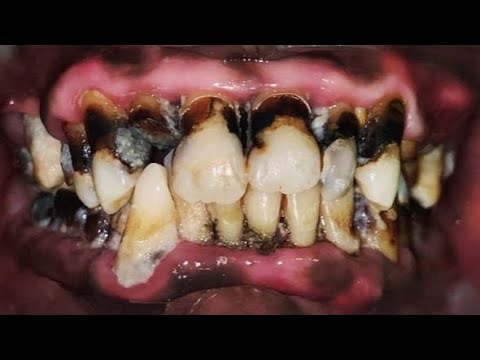 Incredibly shocking calculus!