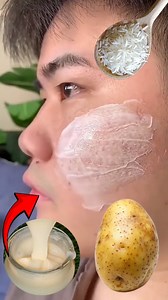 Mix Potato With Rice ~ the secret nobody will ever tell you ~ thank me later ! #antiaging #glowingskin #skincare | Anmol Hindi