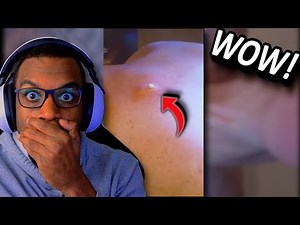 What's REALLY Inside a 10 Year Old Cyst?!