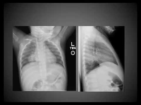 2015 AOCR Radiology Case Review: Pediatrics