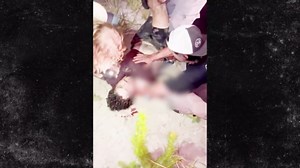 Florida Man Loses Arm to Alligator In Attack Outside Bar