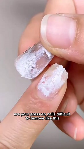 29K views · 190 reactions | Comment “GLUE” and check your inbox — I’ll send the glue kit link straight to you! The best part about our 3-in-1 Magic Glue Kit? It doesn’t just hold your nails — it also helps you remove them safely without damaging your natural nails. | Nail Handy | Facebook