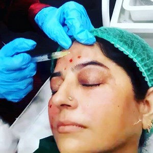 #prp #skinrejuvenation #finelines #wrinkles #youngagain #DrSehrish #appointments #Cosmetologist #PMUspecialist #Lahore #karachi #Dubai 03314303938 | Expression Aesthetics