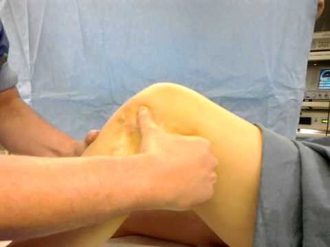 Drawer Test Knee (Schuiflade Test) by RPA Janssen M.D.