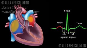 79K views · 1.1K reactions | Cardiac Conduction System And Understanding ECG | Meddy Bear | Facebook
