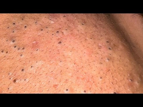 10 Daily Facial Care Routines For Glowing Skin *NATURALLY*