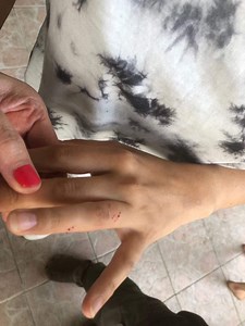 Misconceptions about snakes (things everybody thinks of snakes)