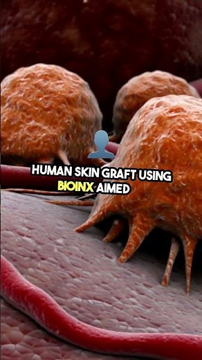 What is Biomaterials? #Biomaedical #Engineering