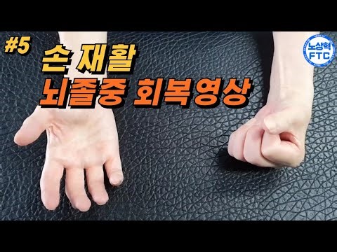 뇌졸중 재활운동(손의 회복 -Shoulder hand syndrome)