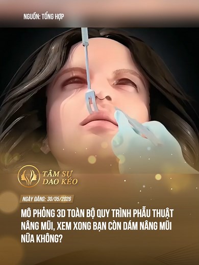 Mô phỏng chi tiết quá trình nâng mũi nhé chị em#theanh28 #tamsudaokeo #tiktoknews #fyp