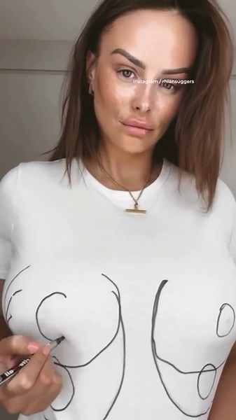 Rhian Sugden shows off results of breast reduction surgery on Insta