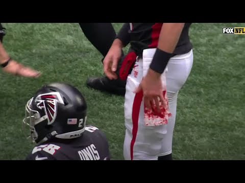 Matt Ryan bloody hand after getting cleated