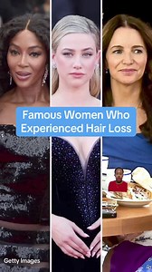 223K views · 633 reactions | Here are some celebrity women who've dealt with hair loss | BuzzFeed | Facebook