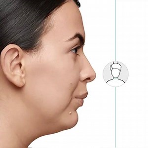 3.9K views | Freeze stubborn fat cells for good with CoolSculpting®,...