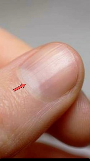 The white, crescent-shaped area at the base of the fingernail is called the lunula! #humanbodyfacts #humanbody #medical #facts | Medical Journal Daily
