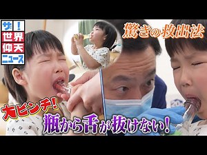 瓶から舌が抜けない！医師がひらめいた驚きの救出法とは！？【ザ！世界仰天ニュース】