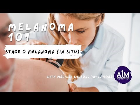 What is Stage 0 (in situ) Melanoma?