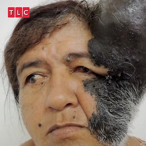 She was born with a birth mark which grew into a giant tumour 😳😦 #BodyBizarre | TLC UK