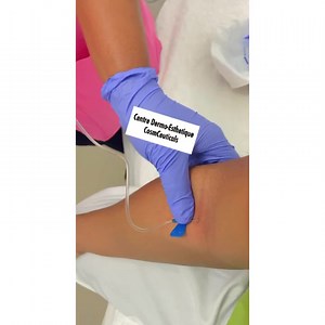 ❤️❤️❤️❤️❤️❤️❤️❤️❤️❤️❤️ GLUTA SHOT Injection Glutathion IV #eclaicissant #detox #eclaircissantabidjan | Cosmceuticals