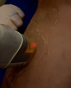 121 reactions · 13 shares | As one ages, and especially in women, the...