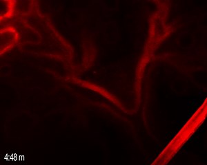 File:Fetal-Calcium-Regulates-Branching-Morphogenesis-in-the-Developing-Human-and-Mouse-Lung-Involvement-pone.0080294.s002.ogv - Wikimedia Commons